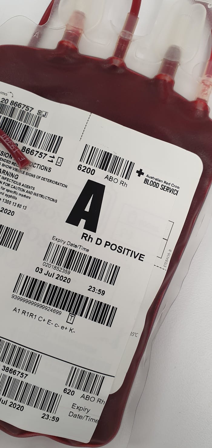 Detailed image of an A Rh D positive blood donation bag for medical use.